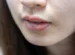 bibir bengkak