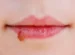 bibir kering saat puasa