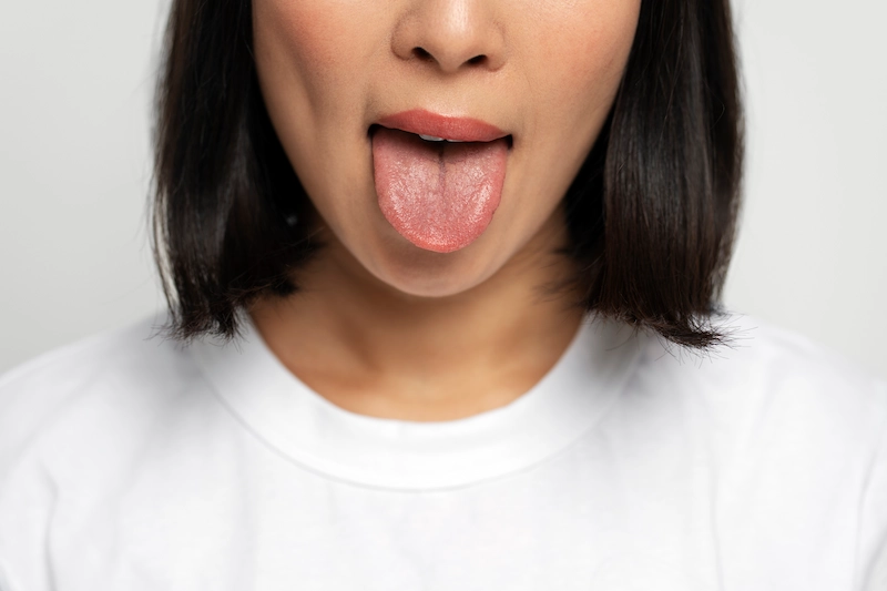 cara mengobati lidah mati rasa karena flu